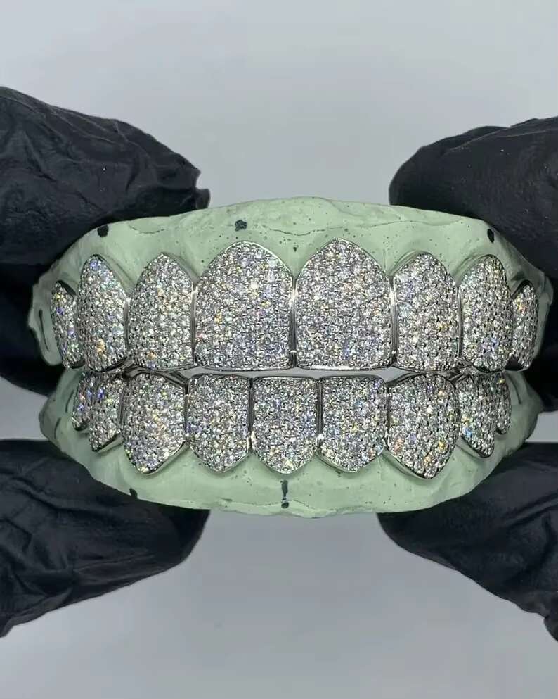 925 Sterling Silver VVS Moissanite Grillz in Diamond Tester Approved Moissanite Diamond Teth