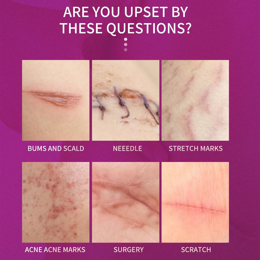 Professional Grade Fade Out Treatment Cream: Intensive Care For Scars & Discoloration