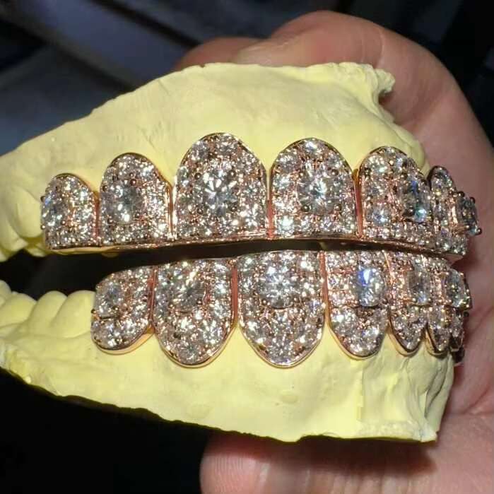 Custom HipHop Iced Out Gold Moissanite Diamond Grillz - VVS Dental Jewelry Bling Teeth Grills Permanent Cut