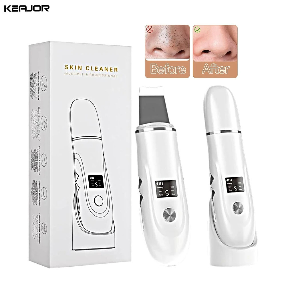 Blackhead r Ultrasonic Skin Scrubber Pore Peeling Spatula Blackhead Removal Shovel Face Deep Cleaning Device 250523