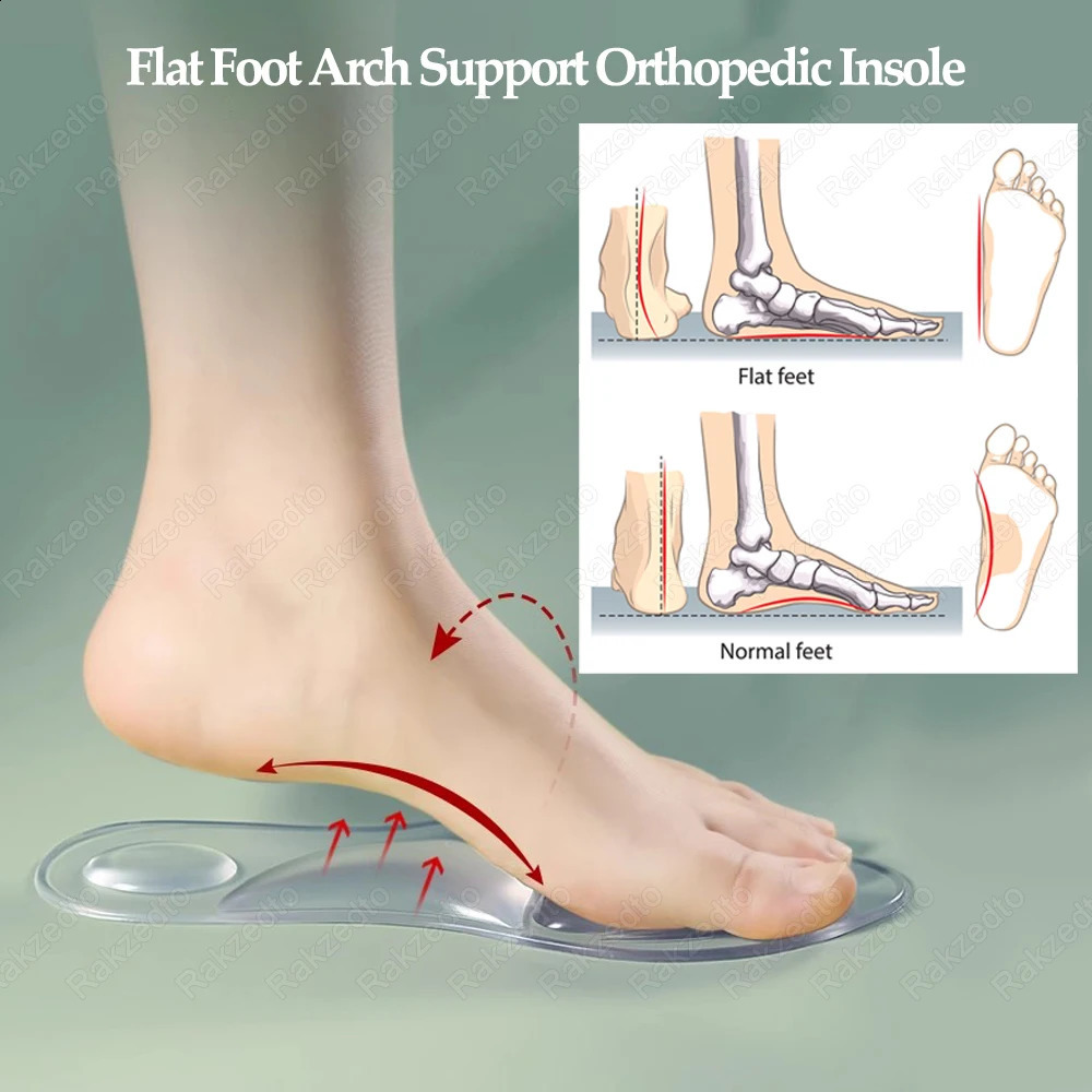 Silicone Orthopedic Insoles for Shoes Women FlatFoot Arch Support Insoles for Plantar Fascitis Foot Massage Gel Shoe Pad 250528