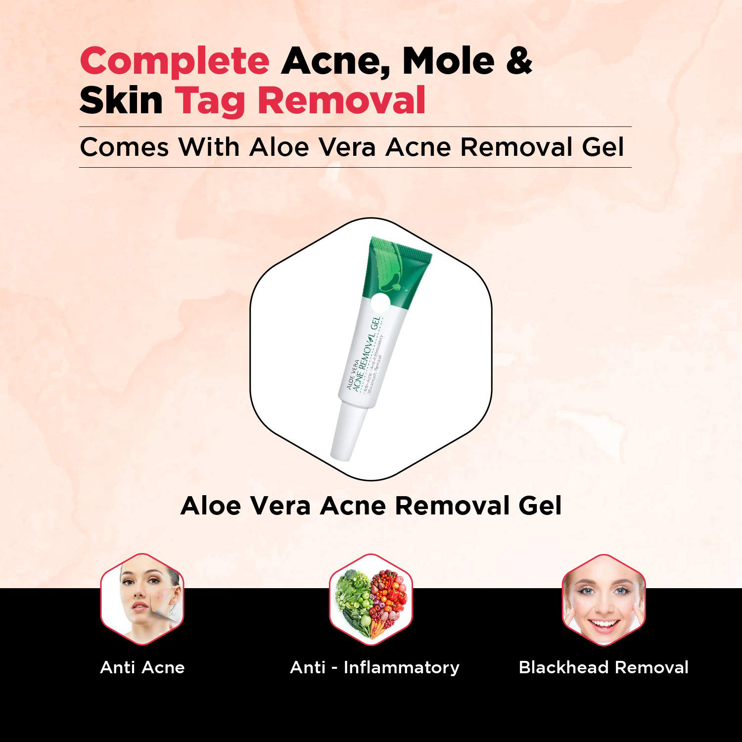 Skin Tag Remover Kit with Rubber Bands for Mole & Wart Removal - Includes Aloe Vera Gel