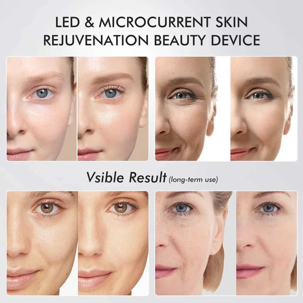 6 in 1 Age Booster Skin Care Facial Glow Booster Beauty Device Facial Skin Care Tools Anti Aging Microcurrent Lift Face CareXJ250607