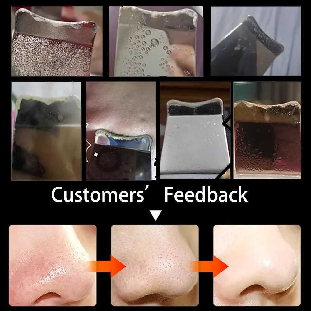 Electric Skin Scraper Peeling Blackhead Remover Ultrasonic Deep Face Cleaning Lifting Acne Pore Facial Spatula Shovel Cleanser XJ250607