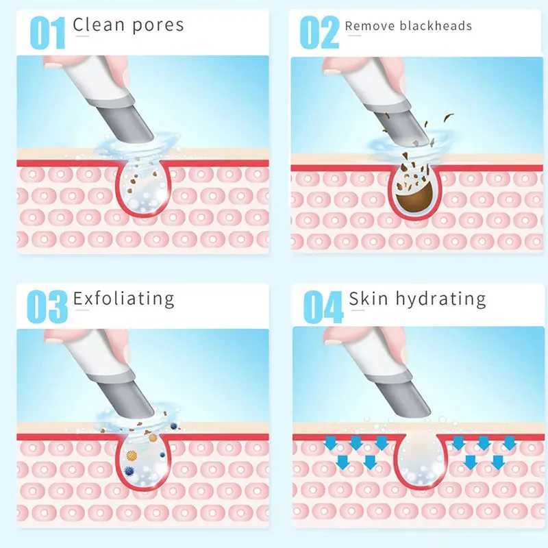 2IN1 Small Bubble Vacuum Acne Pore Cleaner Blackhead Remover Skin Deep Cleaning Beauty Care Tools Moisturizing Beauty InstrumentXJ250607