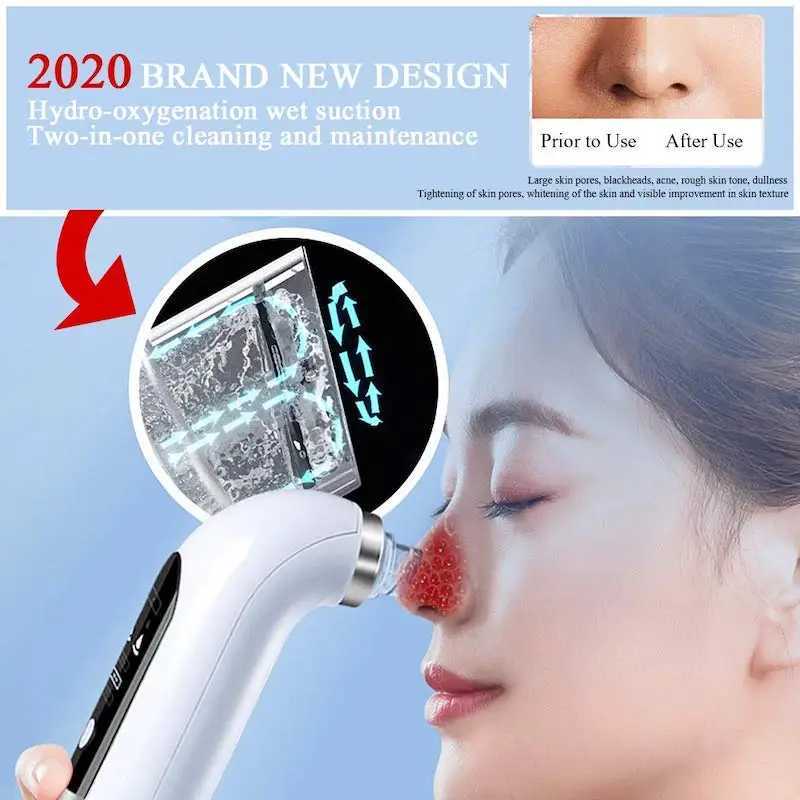 Electric Small Bubble Blackhead Remover USB Rechargeable Water Cycle Pore Acne Pimple Removal Vacuum Suction Facial Cleaner Tool XJ250607