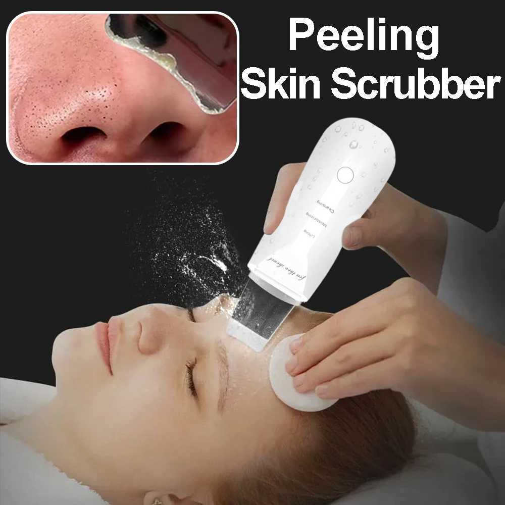 Electric Skin Scraper Peeling Blackhead Remover Ultrasonic Deep Face Cleaning Lifting Acne Pore Facial Spatula Shovel Cleanser XJ250607