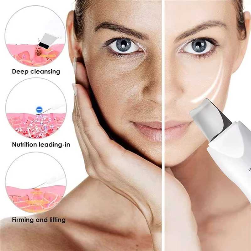 Facial Skin Scrubber Face Spatula Exfoliator Deep Cleansing Tool Blackhead Remover Pore Cleaner Body Skin Spatula Skin Care Tool XJ250607