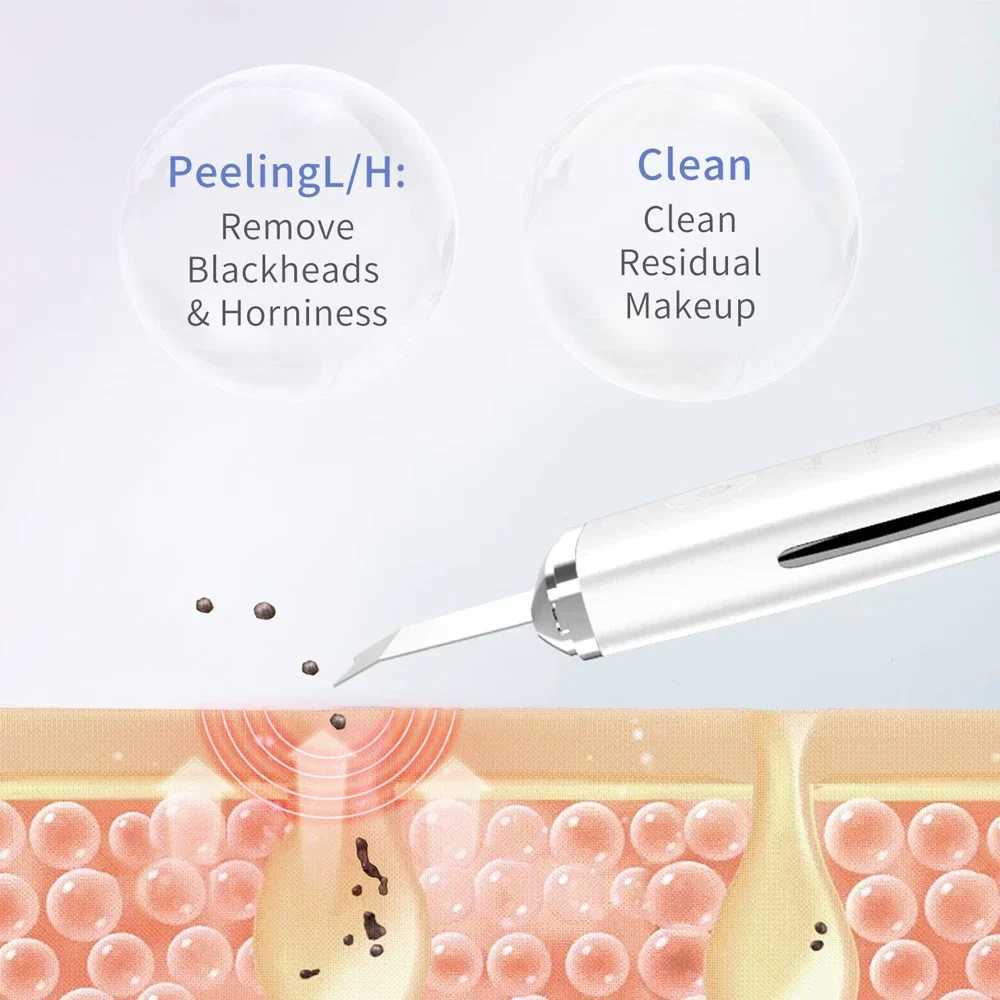 Electric Skin Scraper Peeling Blackhead Remover Ultrasonic Deep Face Cleaning Lifting Acne Pore Facial Spatula Shovel Cleanser XJ250607
