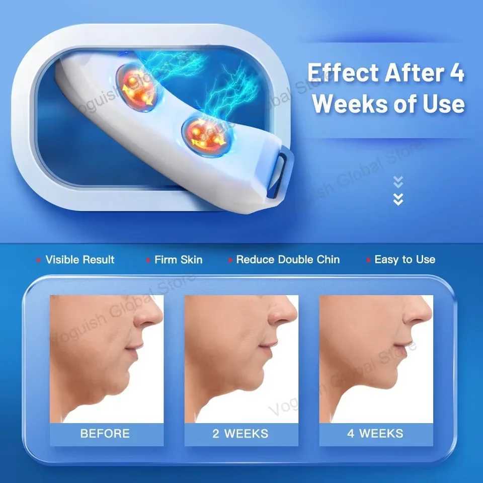 Double Chin Remover EMS Face Lifting Massager Anti Wrinkle Firming Facial Massager V-Face Lift Device Skin Care XJ250607
