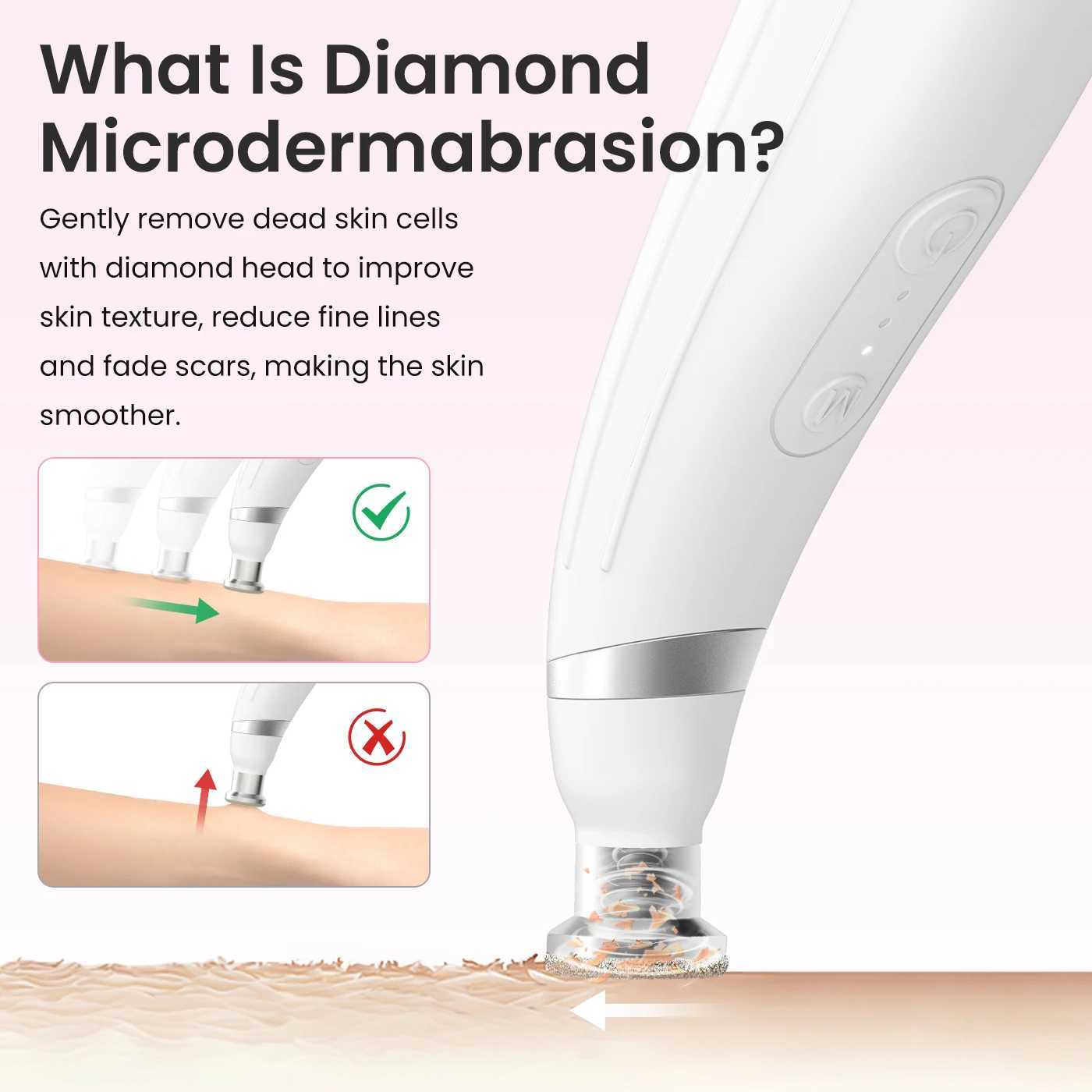 Diamond Microdermabrasion Machine Handheld Cordless Facial Deep Cleansing Tool XJ250607