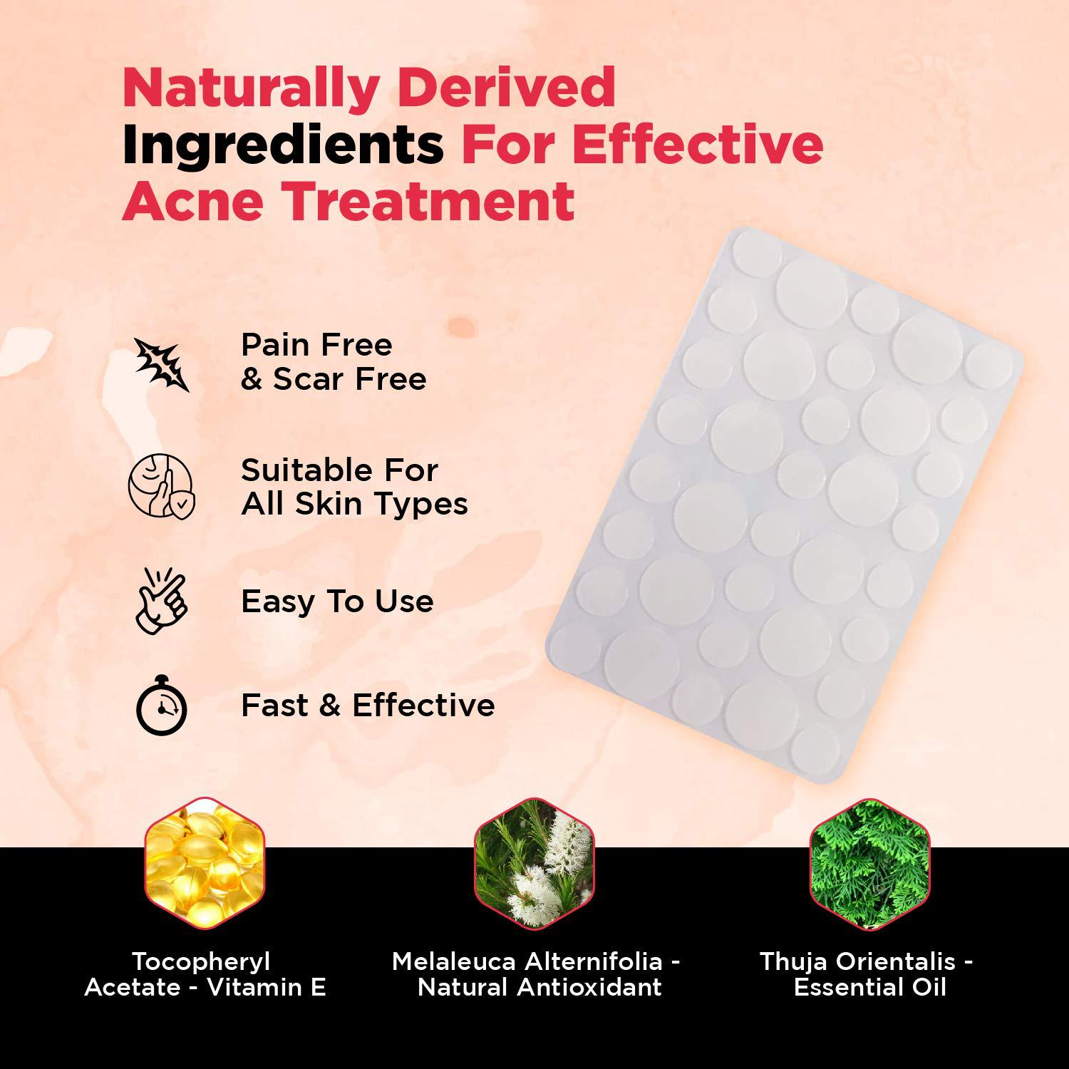 Skin Tag Remover Kit with Rubber Bands for Mole & Wart Removal - Includes Aloe Vera Gel