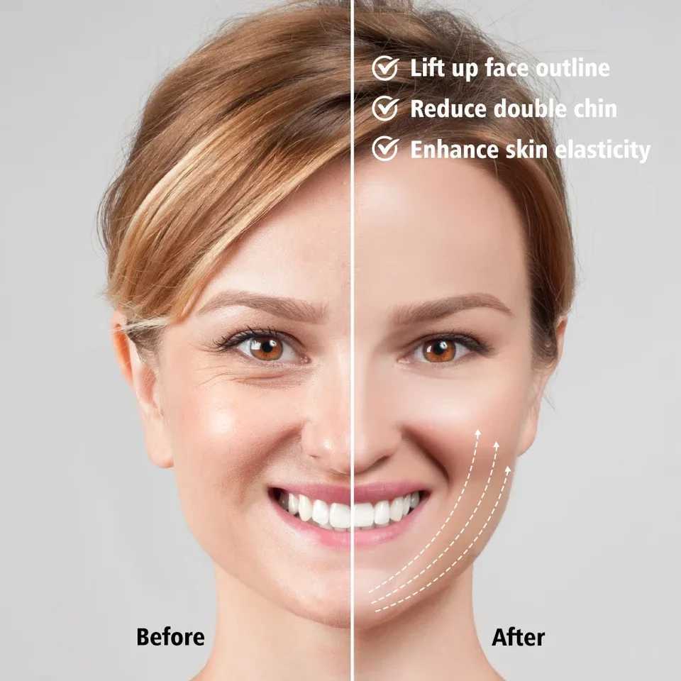 Double Chin Remover EMS Face Lifting Massager Anti Wrinkle Firming Facial Massager V-Face Lift Device Skin Care XJ250607