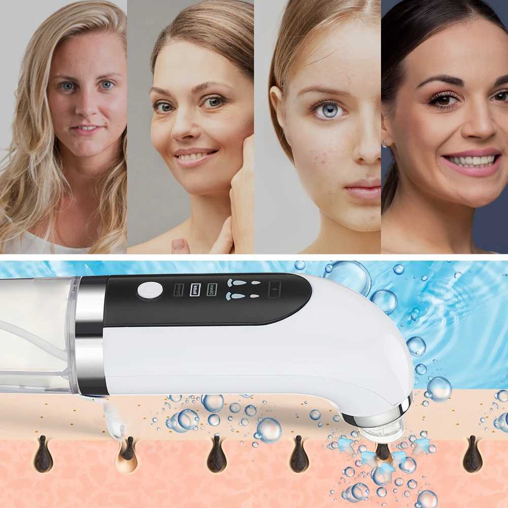 Electric Small Bubble Blackhead Remover USB Water Cycle Pore Acne Pimple Removal Vacuum Suction Facial Nose Cleaner ToolXJ250607