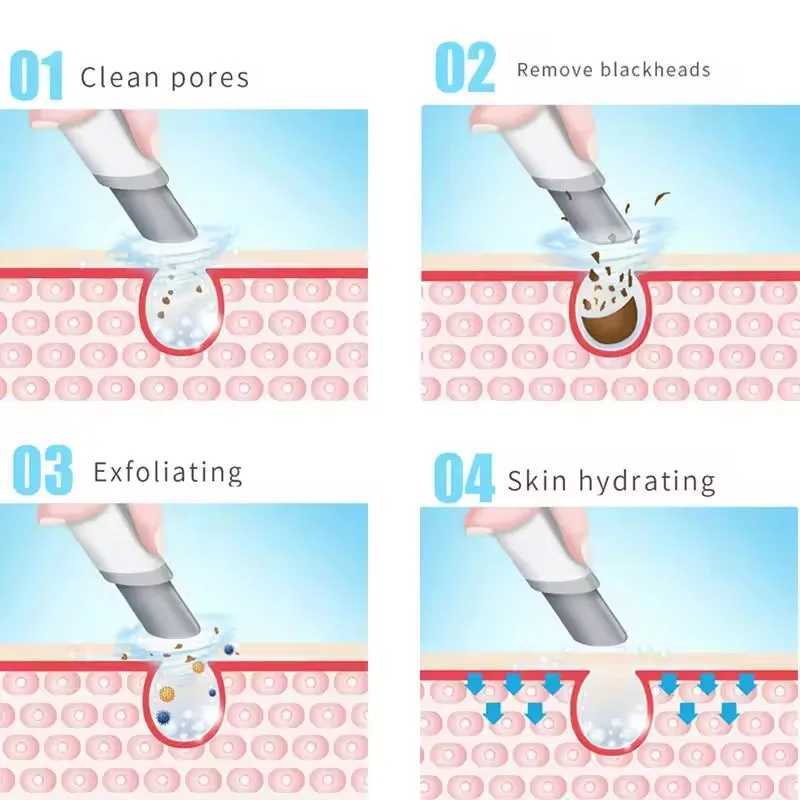 3 in 1 Blackhead Removal Facial Moisturizing Hydro Oxygen Spray Jet Peel Microdermabrasion Micro Bubble MachineXJ250607