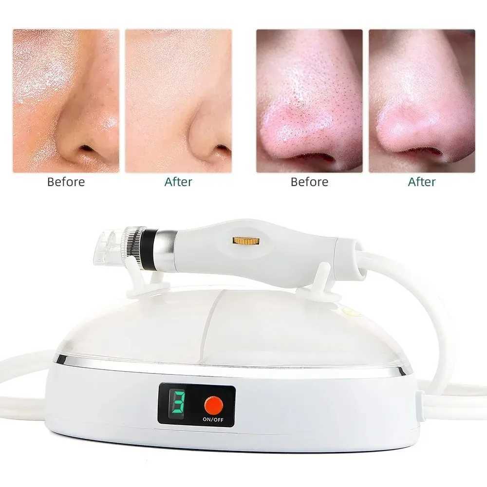 New Facial Blackhead Remover Pore Vacuum Cleaner USB Rechargeable Oxygen Facial Machine Cleaning Jet for Home and Beauty Salon XJ250607