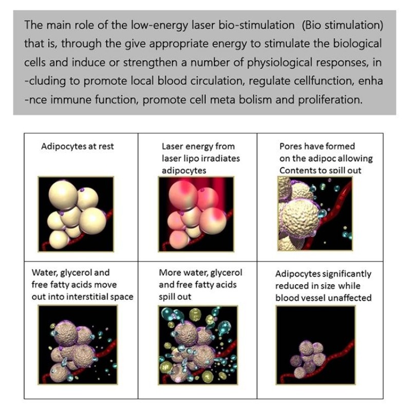 Slimming Machine 2021 Quality 650nm diode lipolaser cellulite removal fat burning lipo laser body machine Beauty Equipment CE Approved222