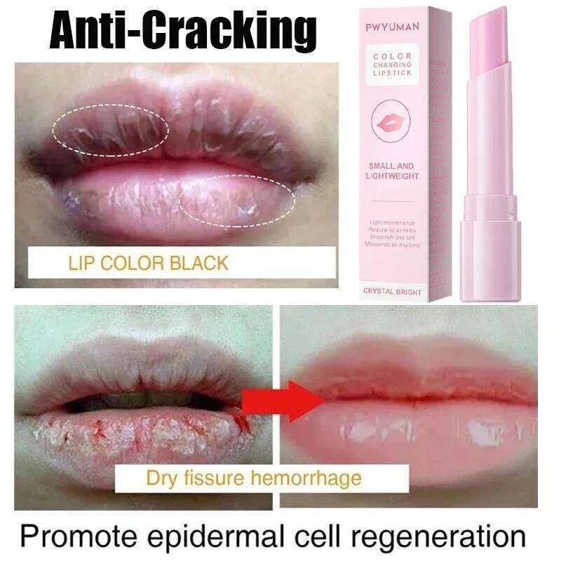 Remove Dark Balm Lightening Melanin Bleaching Gloss Oil Lips Pink Lipstick Exfoliating Fade Lip Lines Korean Cosmetics free shipping