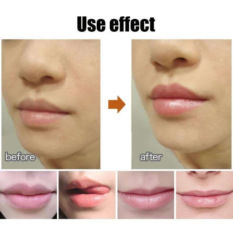 free shipping Cute Ball Shaped Lip Balm - Hydrating, Soothing, and Long-Lasting Lip Plumper with Non-Stick Cup for Preventing Frost Cracking a