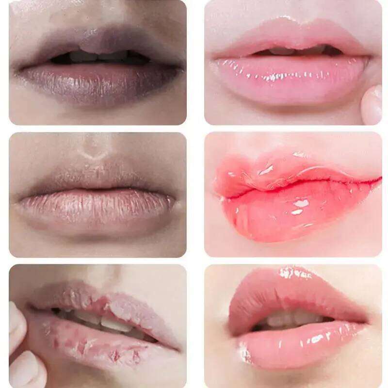 Lips Darkness Removal Peeling Treatments Moisturizing Balm Nourishing Lip Tint Skin Care Products Original Wholesale Beauty free shipping