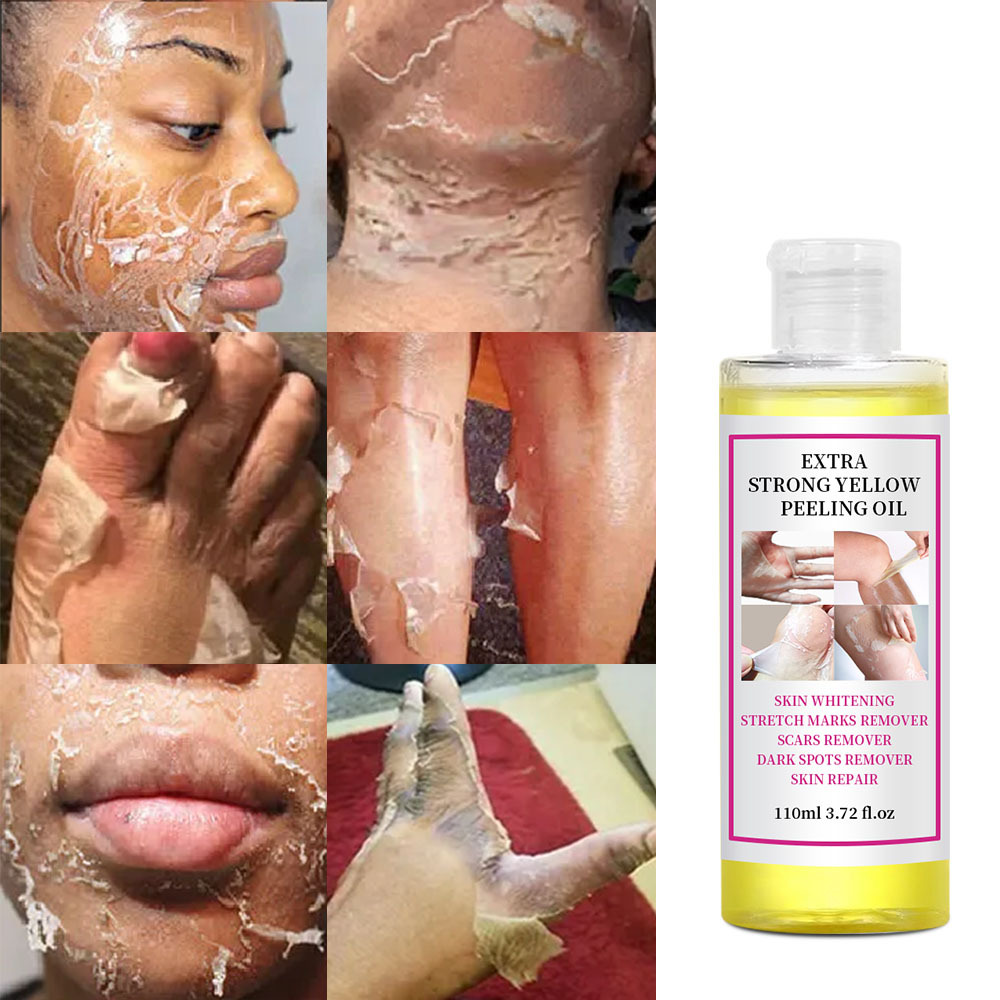 Whitening Peeling Oil Hand Feet Face Whole Body Care Emollient Oil Peeling Oil