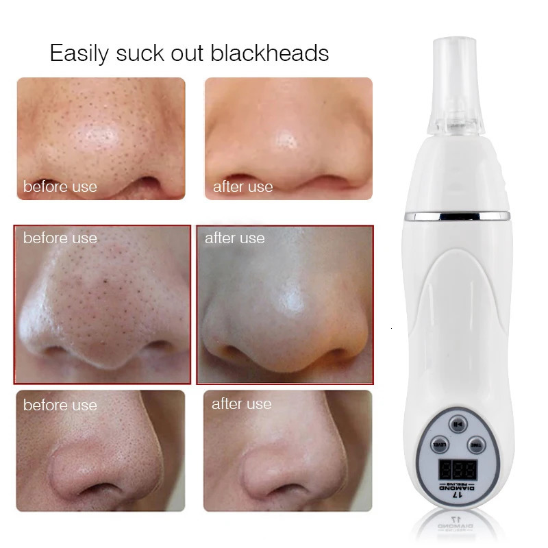 Micro Acne Remover Vacuum Massage Acne Removal Smoothing Cleansing Skincare Drinding Diamond Pen home beauty equipment 250603