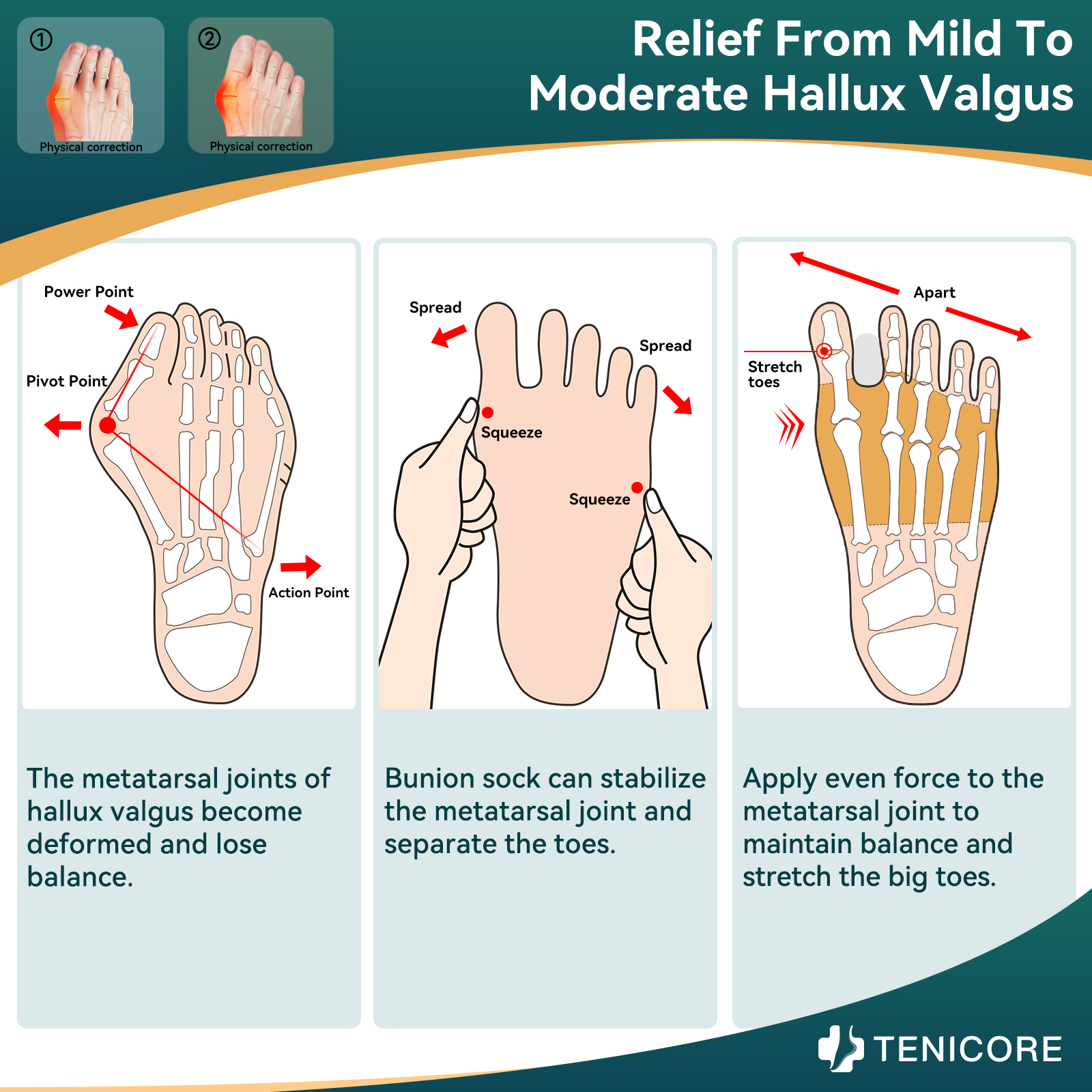 Bunion Corrector for Women Big Toe Straightener for Men, Relief splints Reduce Pain and Correct Toe Alignment, Brace Day/Night, fit for R/L,Washable