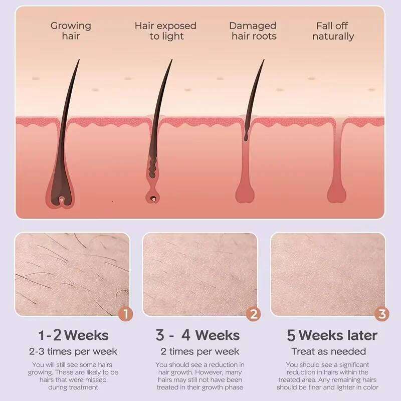 Freezing Point Removal Instrument Household Painless Whole Body Lip Hair Under Armpit Private Parts Special For Women
