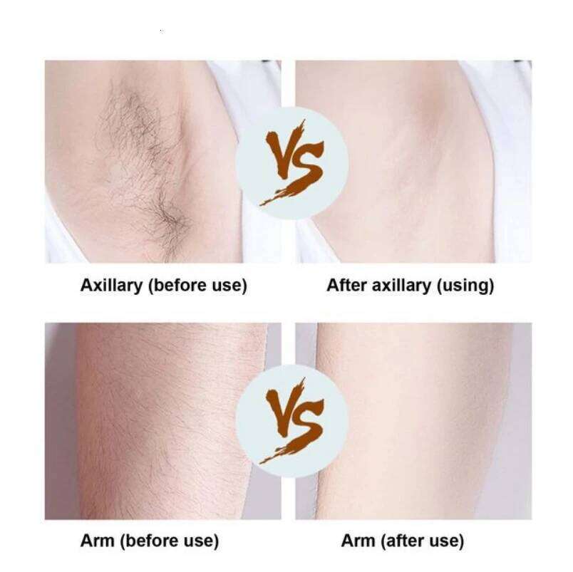 Razor 2-in-1 Trimmer For Women Painless Electric Shaver Removal Hair Face Legs Arms Armpit Bikini Underarm Arm