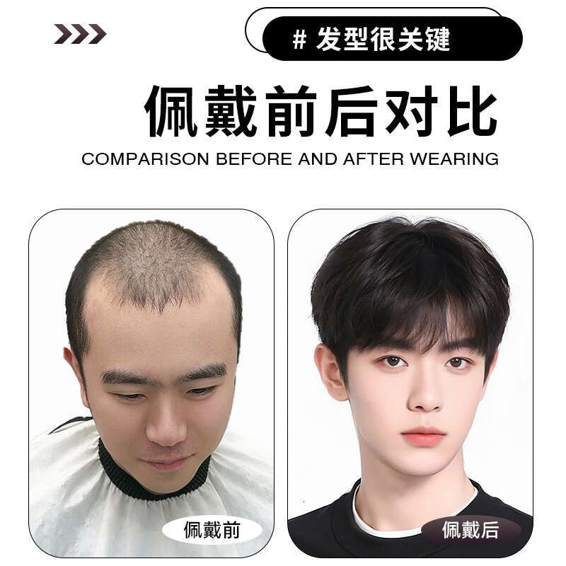 Short Natural Micro Fringe Top Patch Full Real Human Invisible Hair Volume Increase Men's Wig Piece