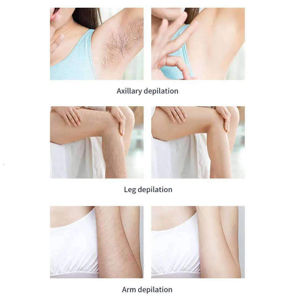 Ice Point Laser Hair Removal Device Home Use, Which Can be Used for Bikini, Armpits, Face, Body, and Legs