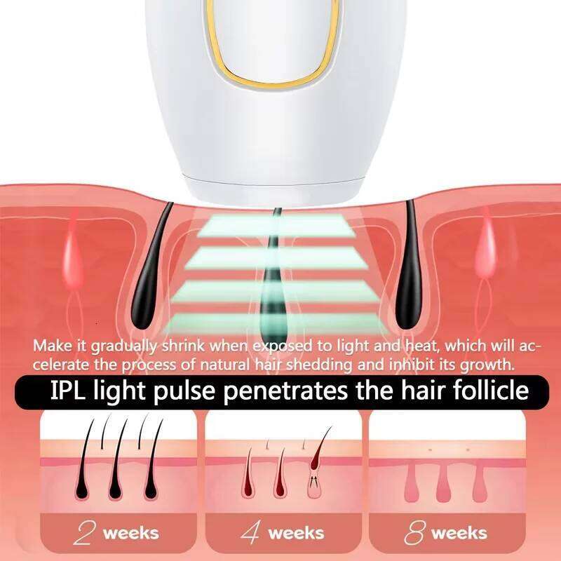Hair freezing point painless laser permanent women's whole body underarm lip private parts hair removal device