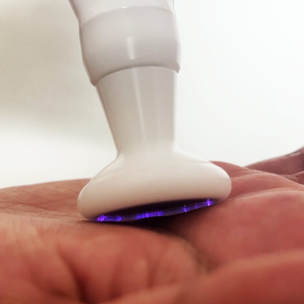 Ozone Face Lift Tightening Shower Pen Cold Jet Plasma Pen Eyelid Plaspot Pores Cleaner Cold Plasma Pen Machine