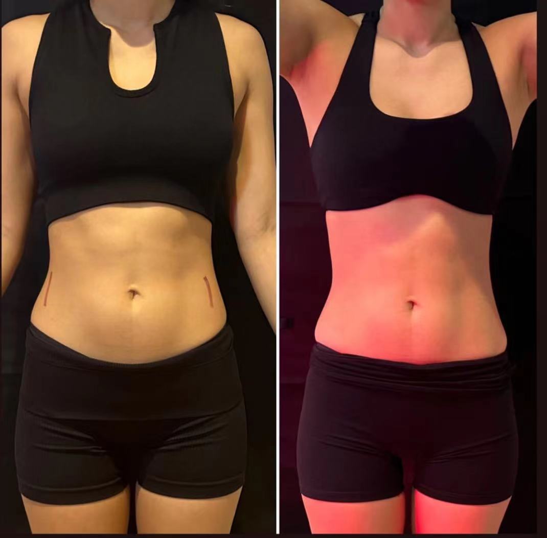 HOT Myoslim Slimming Healthy EMS Body Sculpt Machine RF Sculpt Body Shaping Muscle Machine Electromagnetic Weight Loss