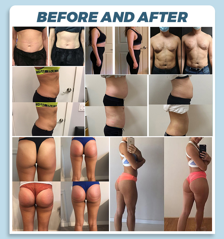 EMSZERO Body Shaping Machine, Fat Reduction, Muscle Shaping and Professional Body Shaping Equipment For Beauty Salons and Slimming Treatments