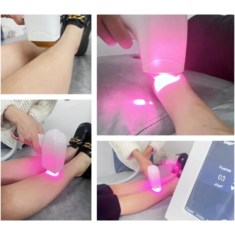 Portable Diode Laser Hair Removal Machine Triple Wavelength 755 808 1064nm Permanent Painless Hair Removal For Home Use Beauty Tool