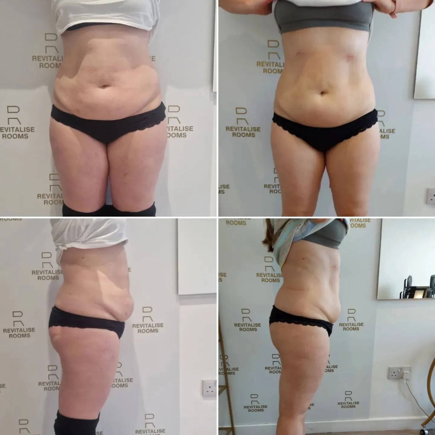 Muscle Toning Machine EMSZERO Fat Burning 15Tesla HI-emt Body Contouring 6500W Slimming Equipment Build Abs Tone Buttocks Professional