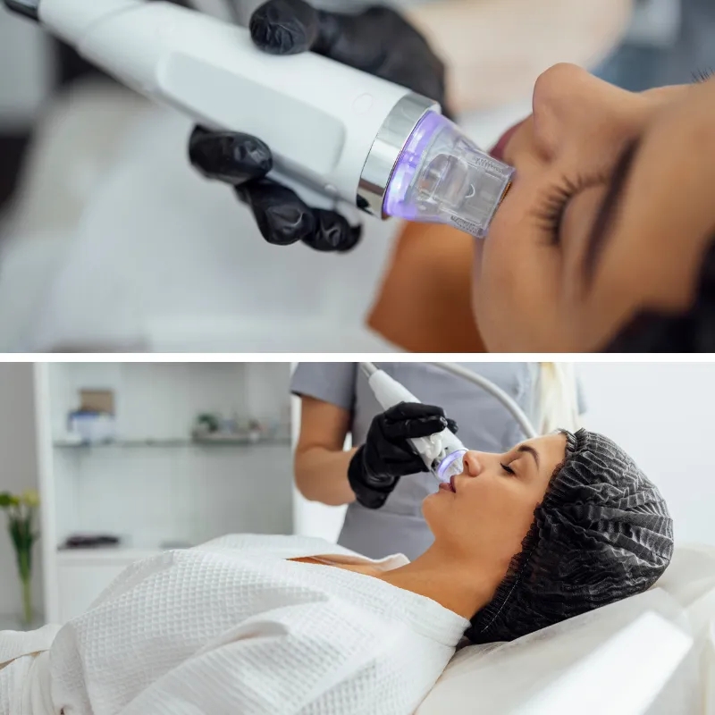 Gold Rf Microneedle Skin Rejuvenation Device, Rf Microneedling Machine Highly Effective Anti-Aging Skin Tightening, Beauty Salon Acne and Scar Removal