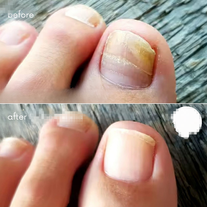 Beauty Salon Aesthetic Equipment Multifunctional 9 In 1 Fibroblast Cold Ozone Plasma Pen Machine High Frequency Spark Plasma For Acne Treatment Face R