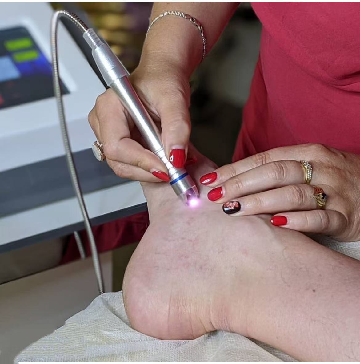 980nm Laser Red Blood Streak Treatment Device 2 In 1 Configuration Streak Removal + Ice Hammer Cold Compress Beauty Salon Dedicated Equipment