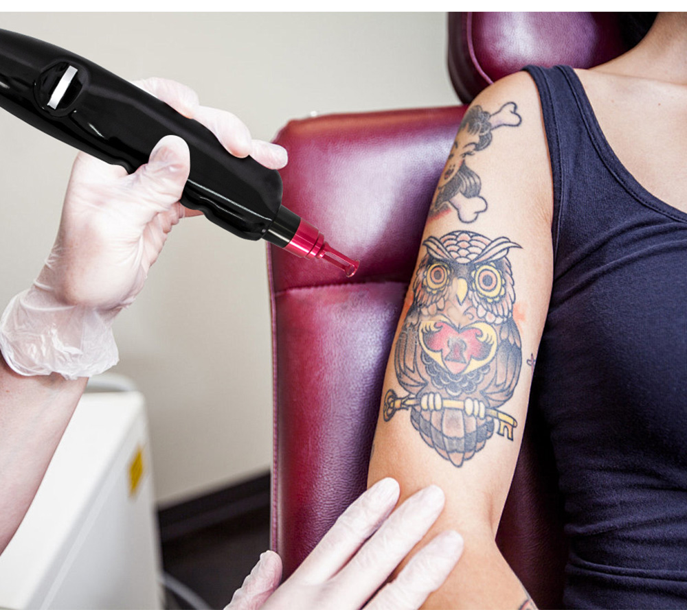Titanium Hair Removal Professional 2-In-1 Diode Laser Pico Nd Yag Picosecond Laser Hair Removal Tattoo Removal