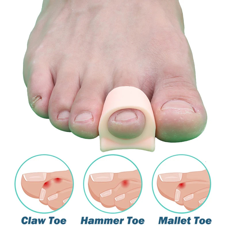 Pexmen 2/4Pcs Gel Soft Hammertoe Corrector Toe Splints Realign Bent Curled Claw Hammer Toes Toe Straighteners for Men and Women 250613