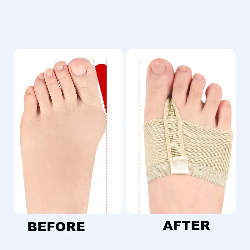 RHBJ 2Pcs=1Pair Girls Women Belly Dance Shoes Soft Sole Feet Protection Toe Pad Well Foot Care Tool Relief Feet Pain Toe Pad 250613