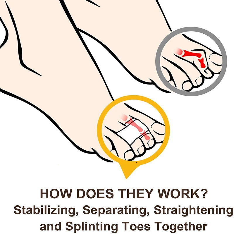 Pexmen 1/2/5/10Pcs Hammer Toe Straightener Toe Splints Bandages for Correcting Hammertoe Crooked Overlapping Toes Protector 250613