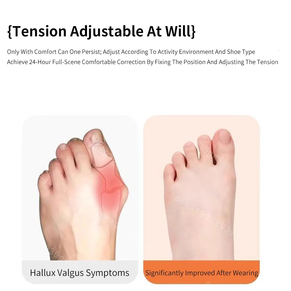 Kinesiology Tape Hallux Valgus Big Toe Corrector Tape for Sports Waterproof Protective Tape Toe Corrector Straightener 250613