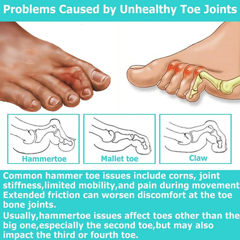 Pexmen 2/4Pcs Gel Soft Hammertoe Corrector Toe Splints Realign Bent Curled Claw Hammer Toes Toe Straighteners for Men and Women 250613
