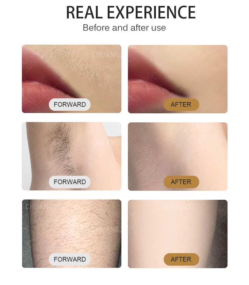 Diode Laser 808nm Hair Removal Machine Alexandrit Permanent Removal 3 Wavelengths Cooling Head Painless Laser Epilator