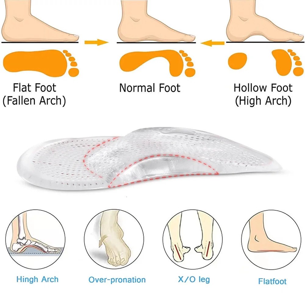 Silicone Arch Support Insoles for Shoes Man Woman Flat Foot Corrector Orthopedic Insoles for Plantar Fasciitis Support Shoe Pad 250617