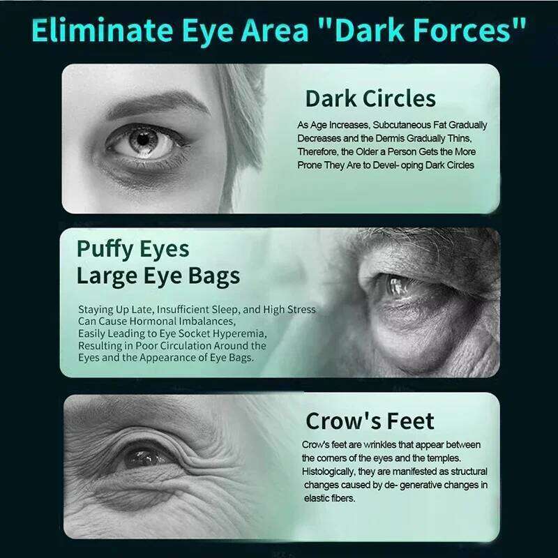 Designer Luxury Electric Massager Wrinkle Aging EMS Eye Beauty Tool Massage Rechargeable Eyes Fatigue Relief Anti Dark Circle Device