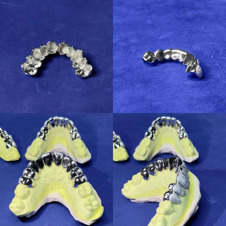 Fashion Jewelry 925 Silver Plated Gold 10 Top 10 Bottom Custom Grillz Vvs Moissanite Teeth Grillz Diamond Grillz